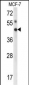 IPMK Antibody (Center)